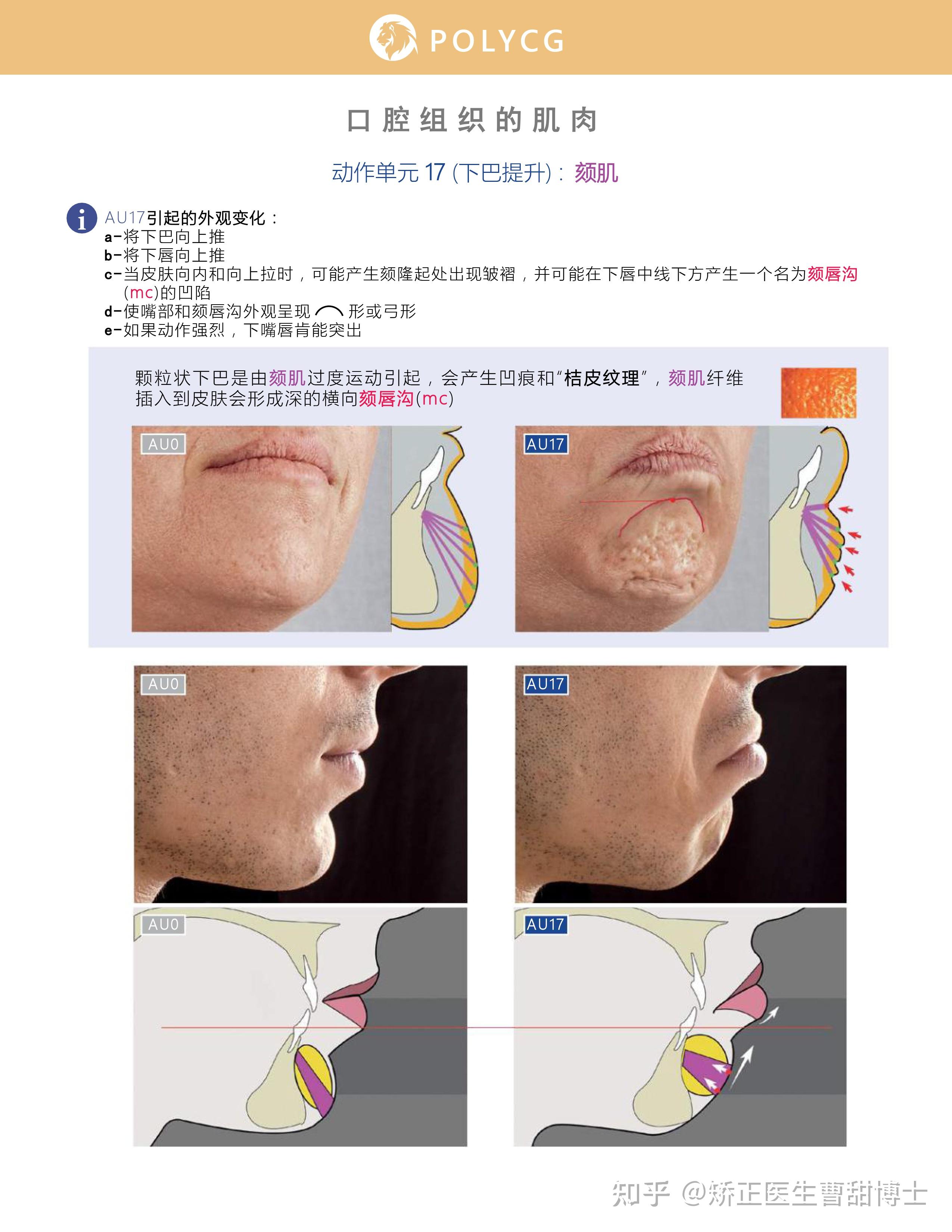 牙齿矫正能改善颏肌紧张吗?