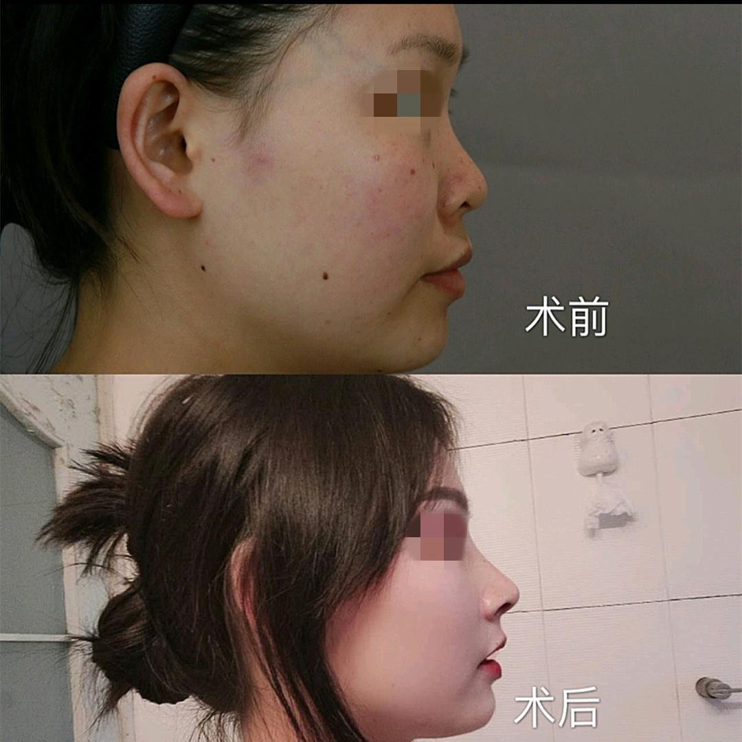 做鼻子比较出名的医生_出名鼻子医生比较做的是什么_做鼻子好的专家
