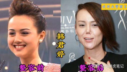 18位女星整容前后对比,有的整容前花容月貌面容娇好 - 知乎