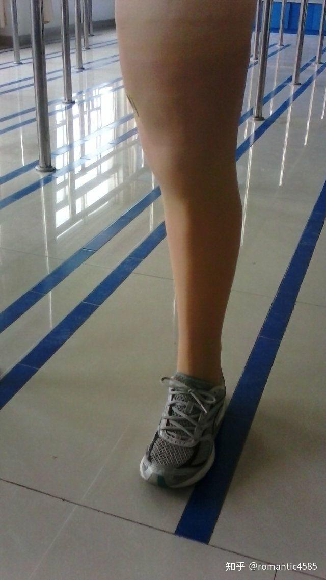 小孩小腿假肢包装人们是怎么弄的像真腿一样78岁小孩子内向不想让其他