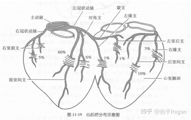 冠状动脉窦解剖图图片