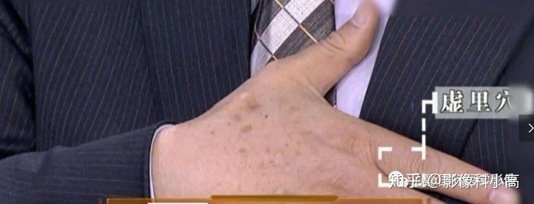 心源性水肿---下肢水肿可能是心脏病变的危险警报