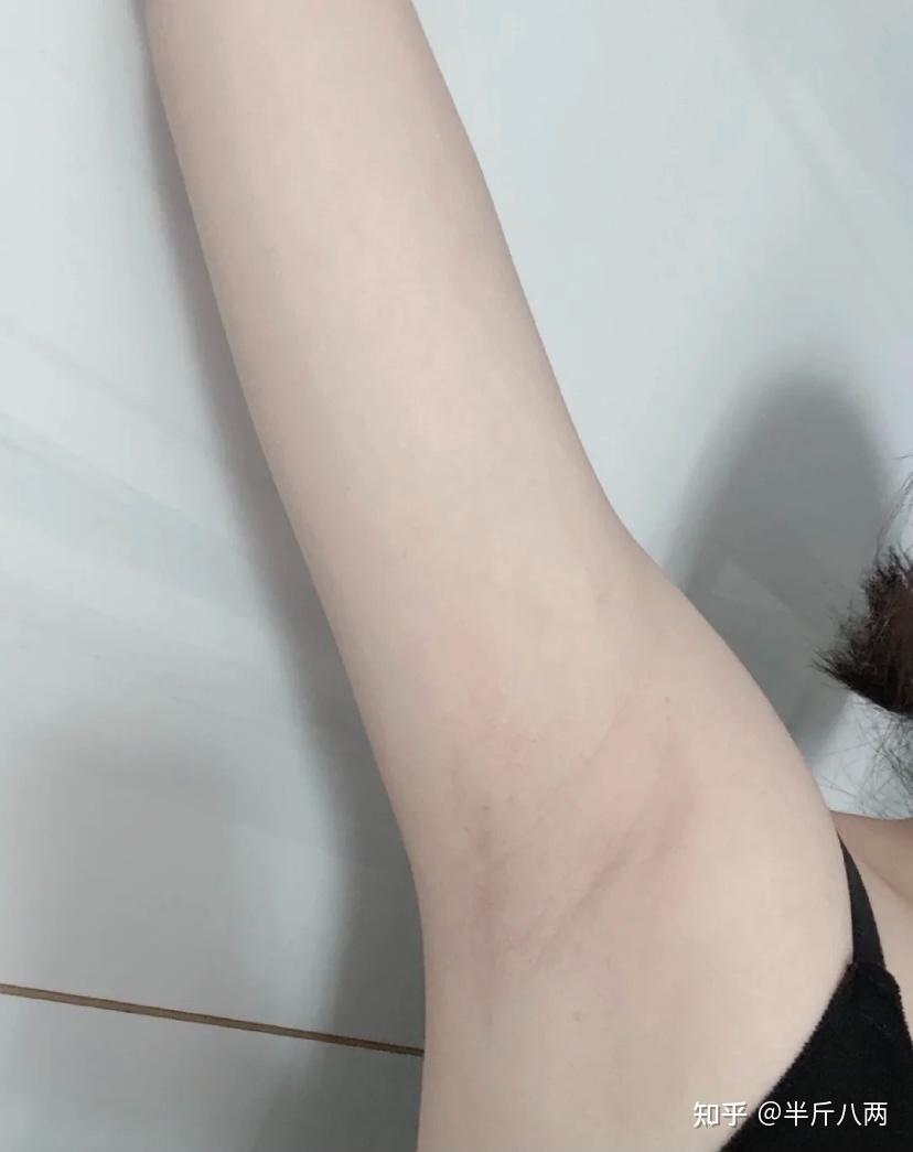 脱毛之前涂身体乳可以吗(脱毛之前涂身体乳可以吗女生)