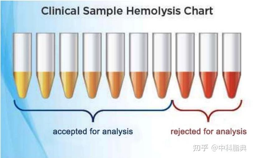 组学研究中血清和血浆样本怎么选?一文读懂! - 知乎