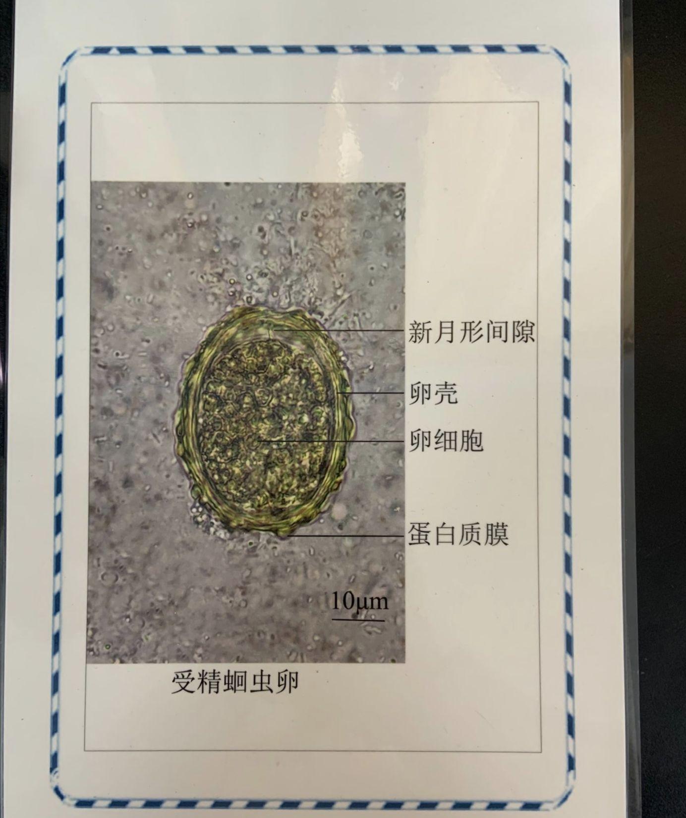 人体寄生虫学铅笔绘图来咯
