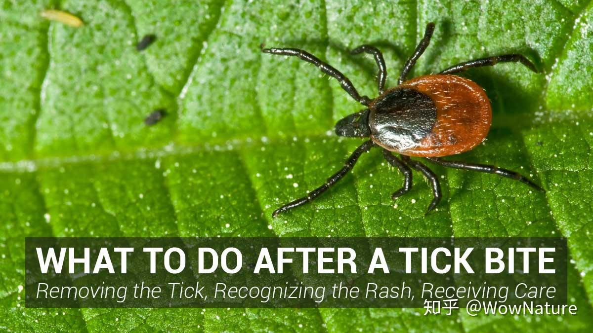 夏天户外如何防治蜱虫(Ticks)及其他昆虫叮咬 - 知乎