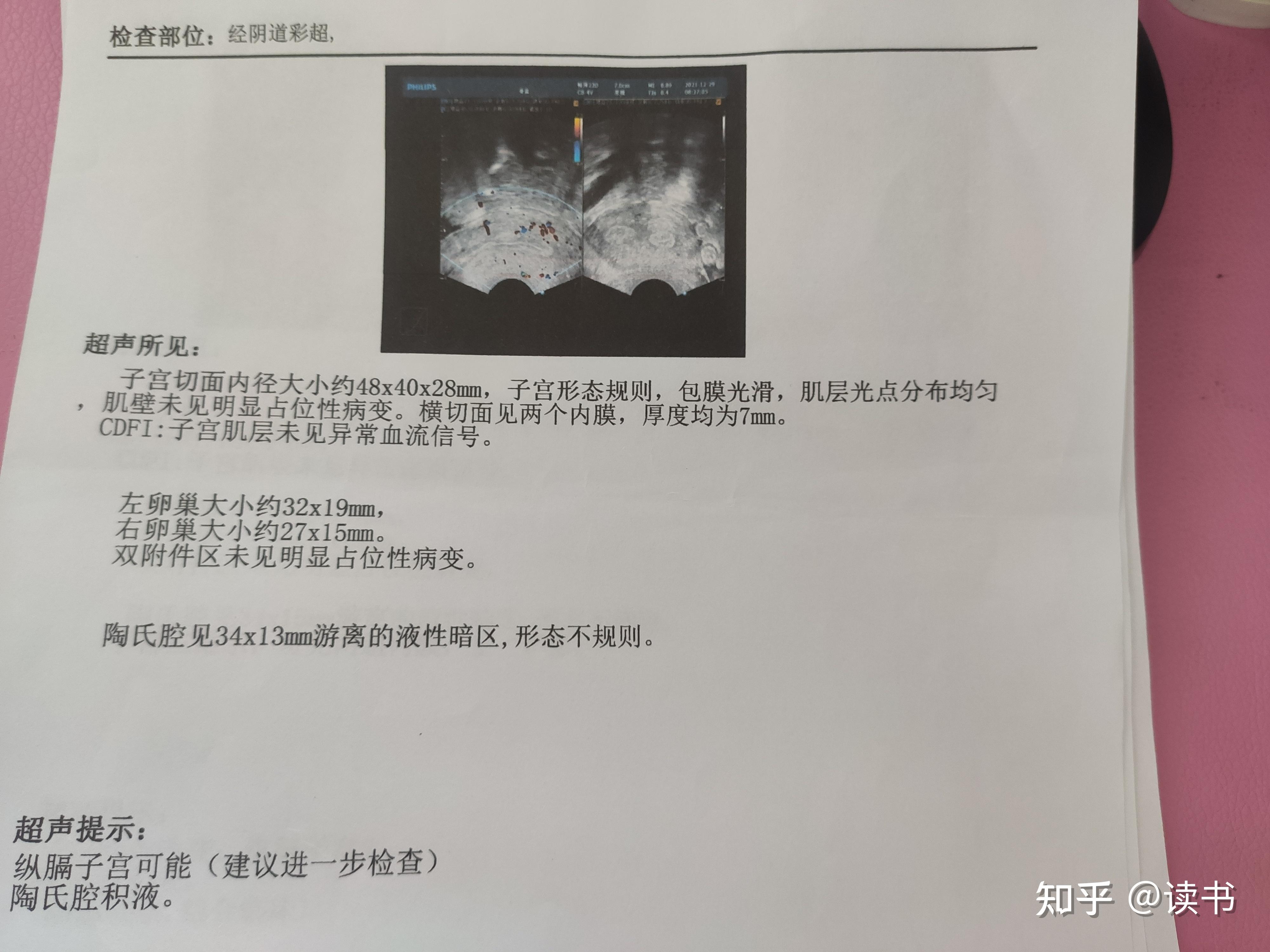 军婚体检那些事