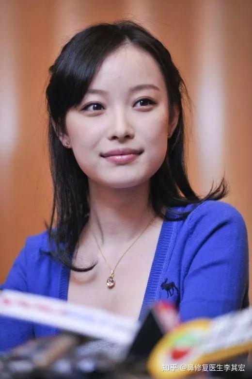 明星的高级脸调整方向值得学习