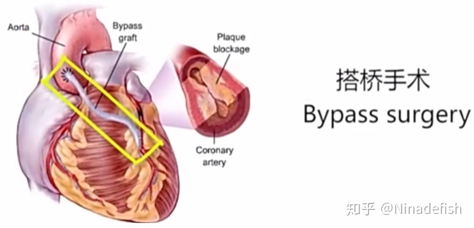 整理心血管系统结构功能与健康