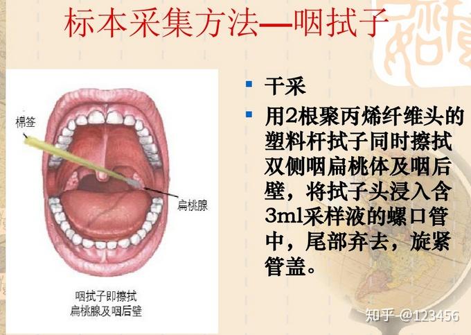 v2-3ccbb6292be8726cf763db88f31d0a6d_r.jpg