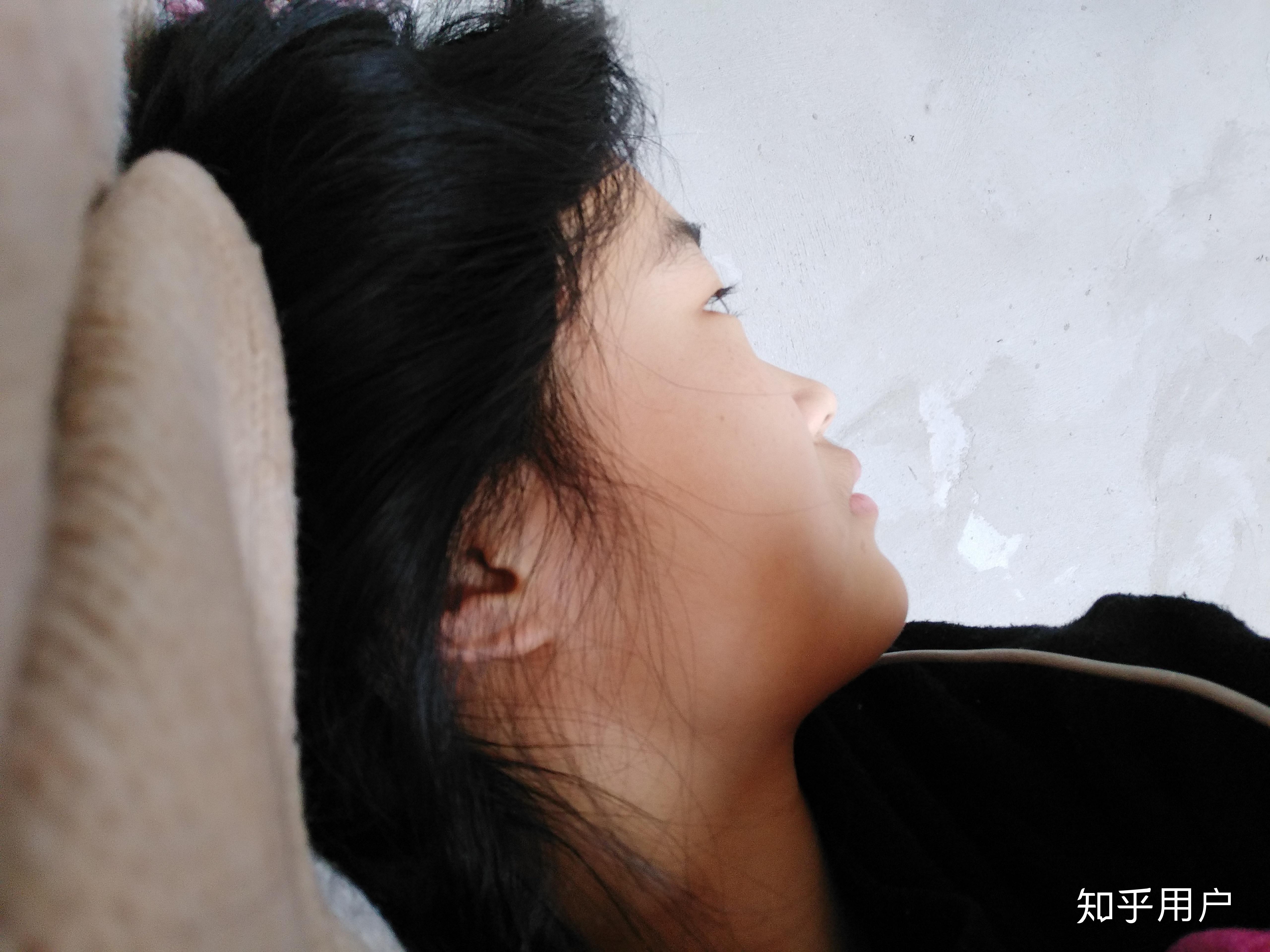 脸方,没下巴,没鼻梁,侧脸难看是一种什么体验? - 知乎