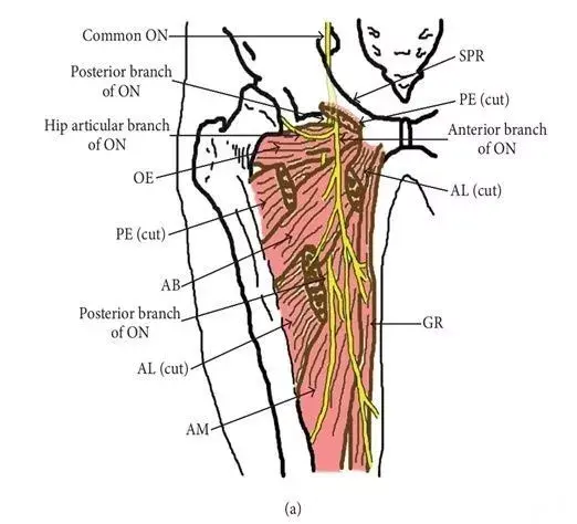 华声临床超声可视化讲座手把手教你超声引导下闭孔神经阻滞的四种入路