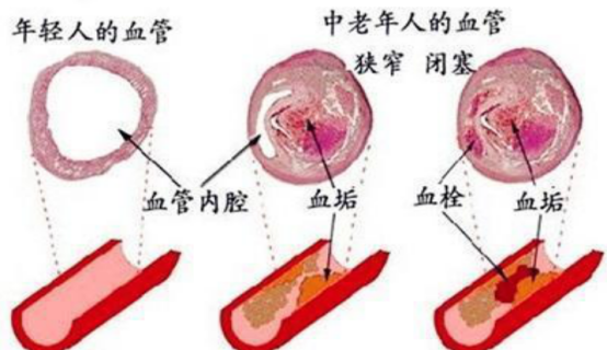 v2-3d252b850f52bbde7c1954b4eda2423d_1440w.jpg?source=172ae18b
