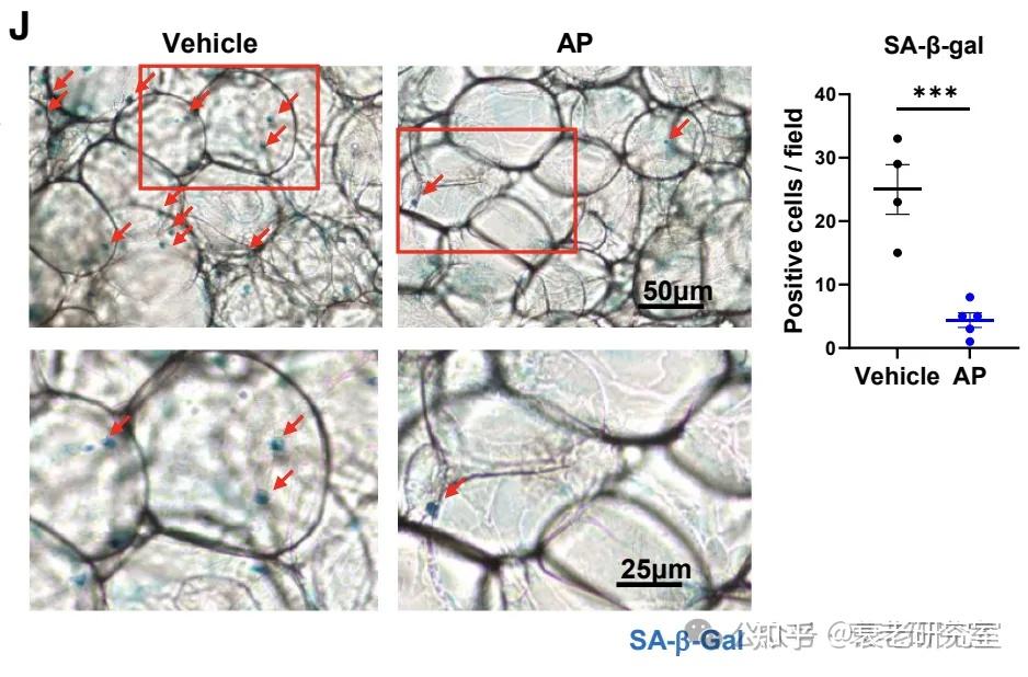 Cell Metabolism: 清除衰老的血管细胞能够改善肥胖代谢! - 知乎