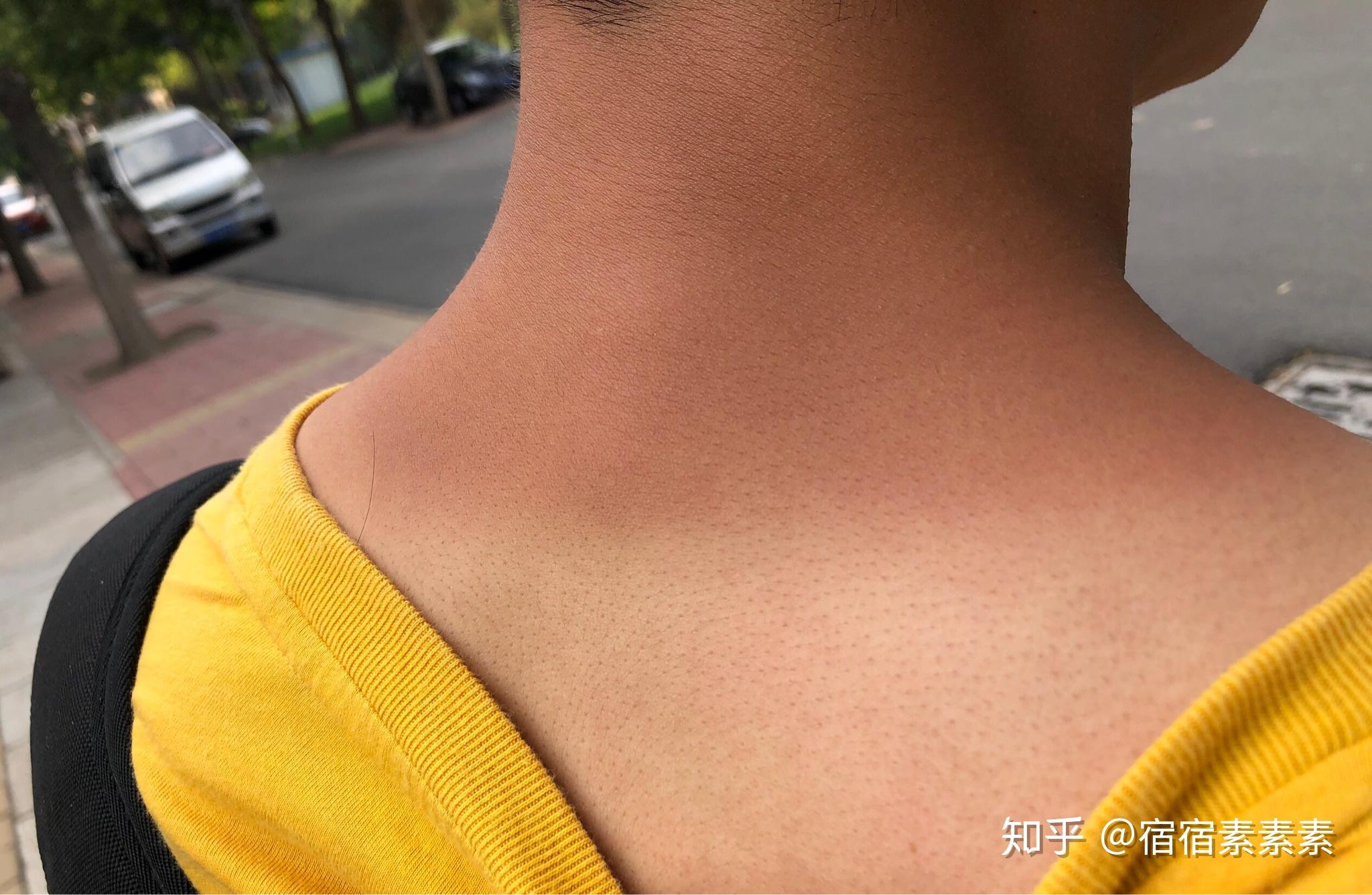 皮肤超好 但是现在……不多说了……第二天中午我们吃的螃蟹和大虾