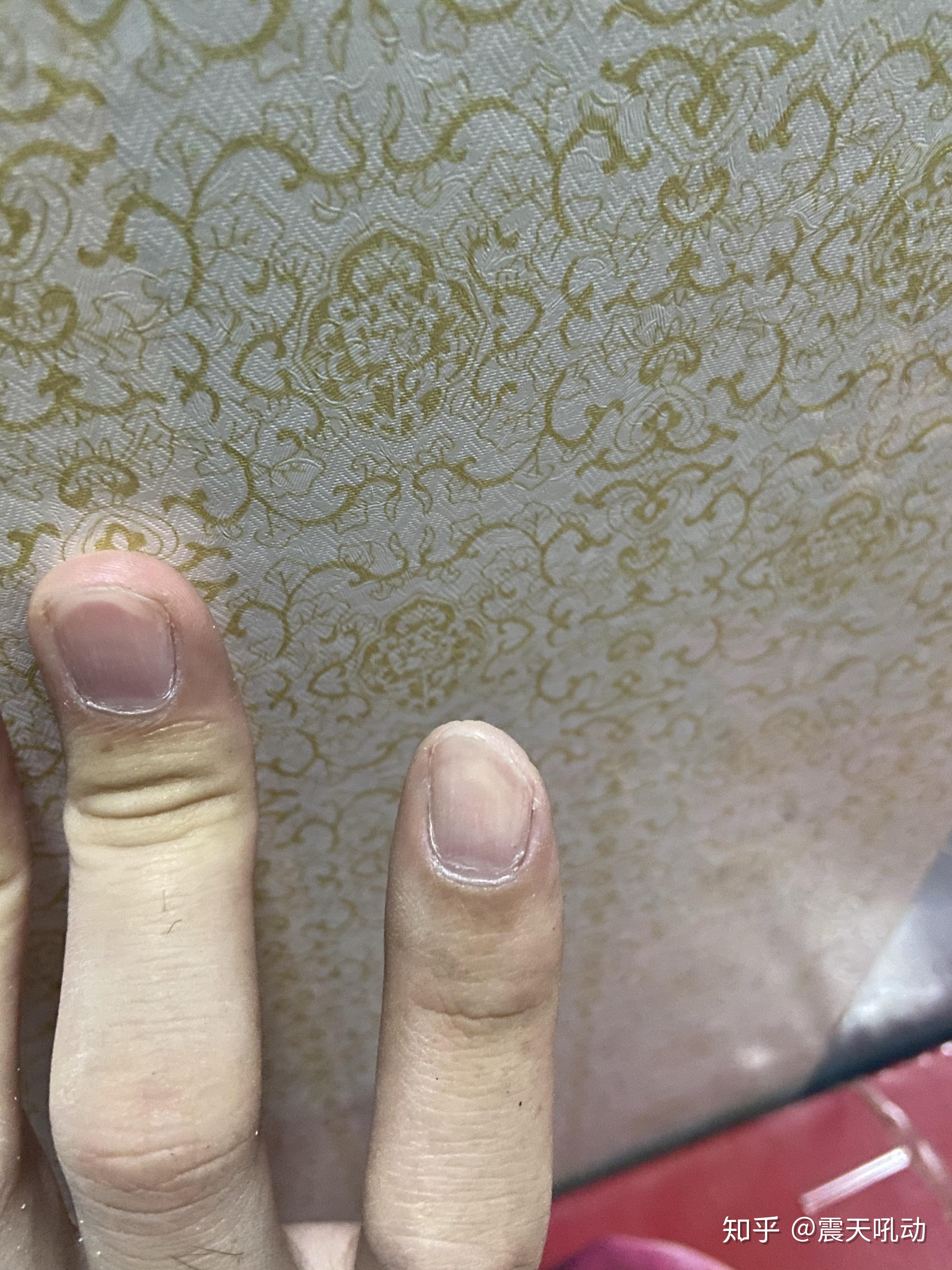 切菜时切到手是一种什么样的体验? - 知乎
