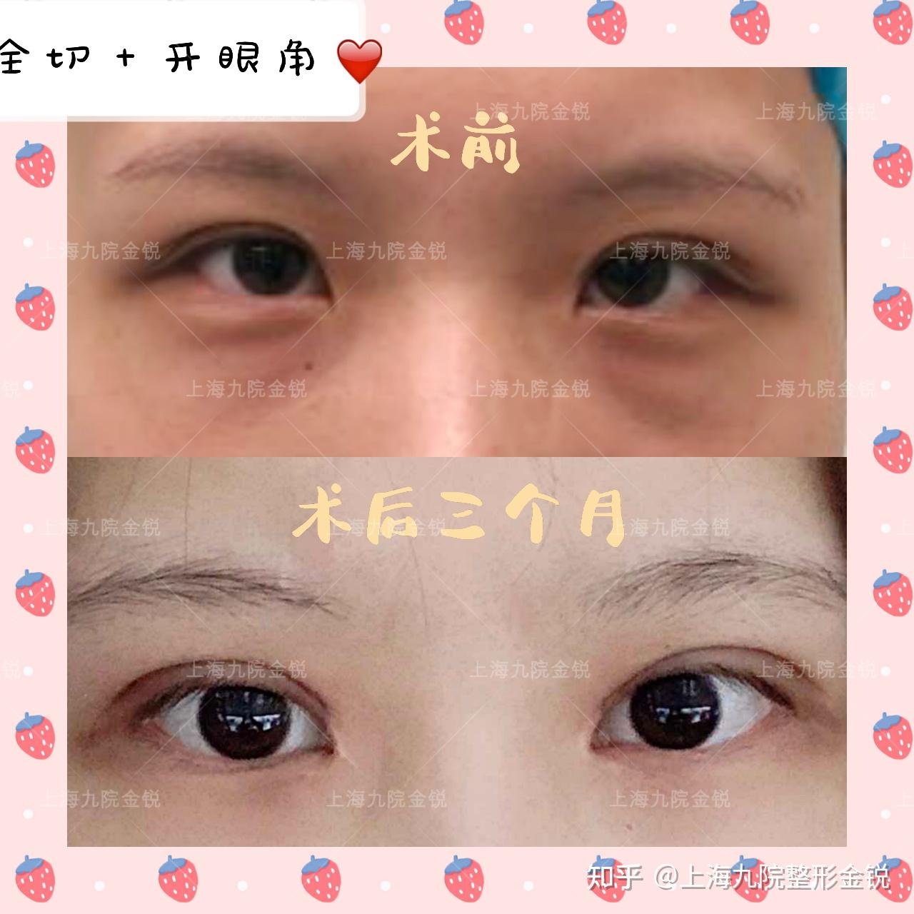 双眼皮VS单眼皮,为什么更多人喜欢双眼皮? - 知乎