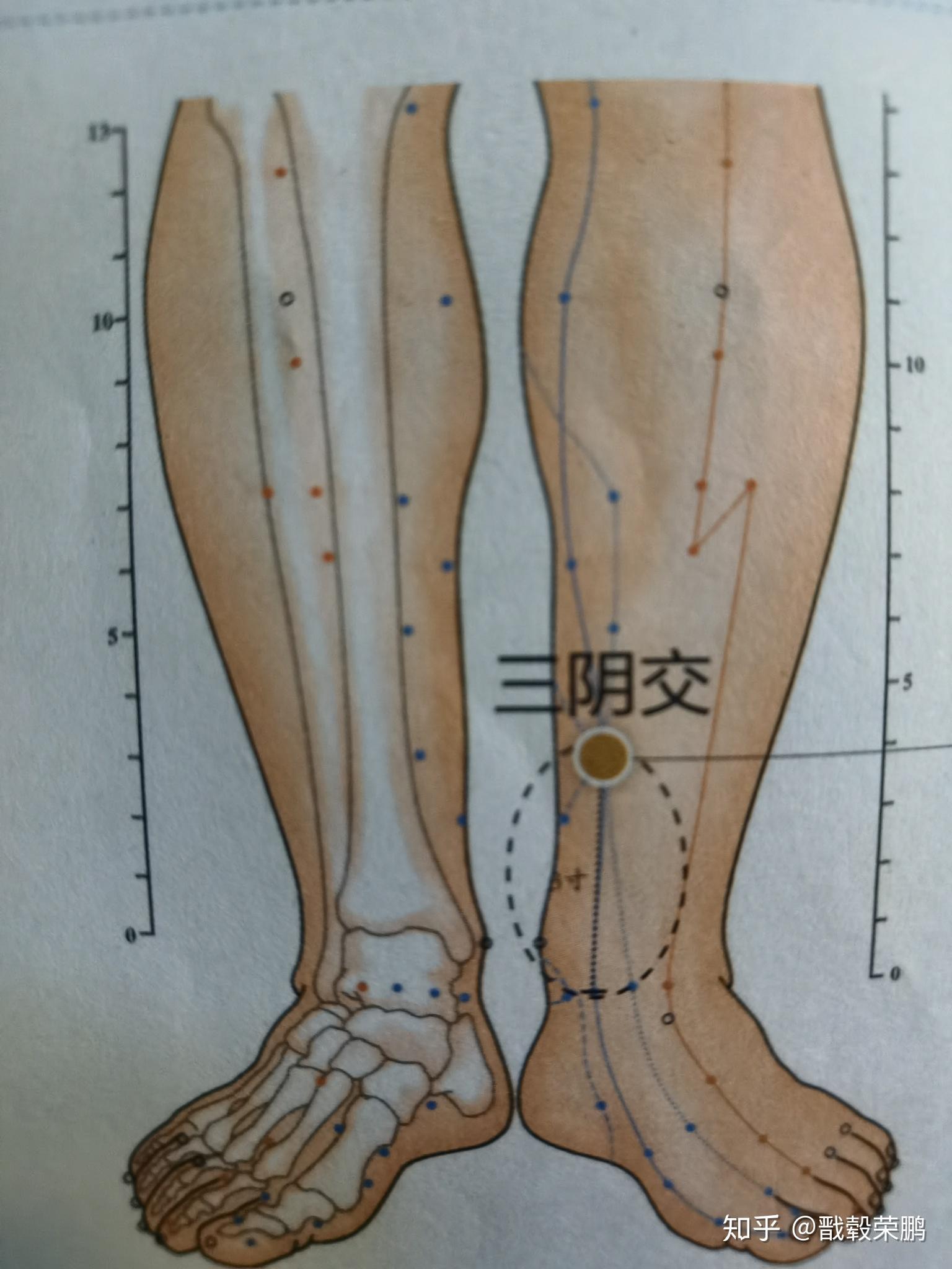 三阴准确位置图片图图片