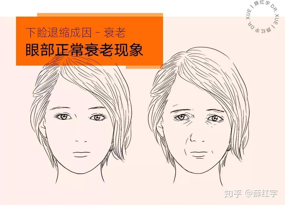 三白眼怎么办? - 知乎