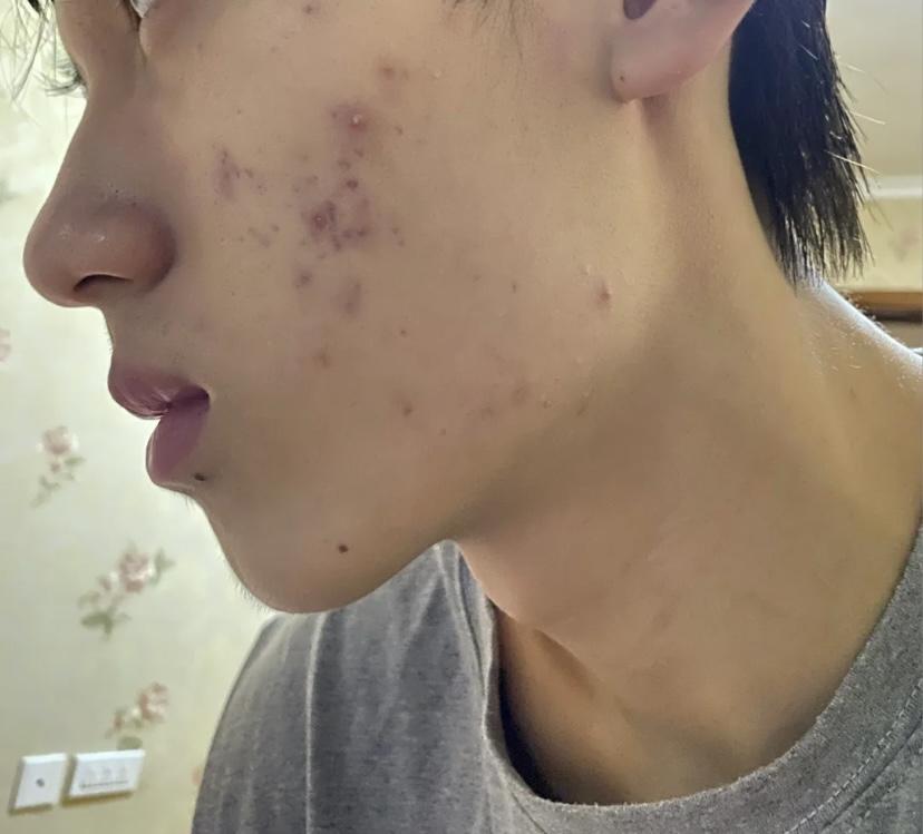 男生有哪些好用的护肤方法能在短时间内达到颜值巅峰?