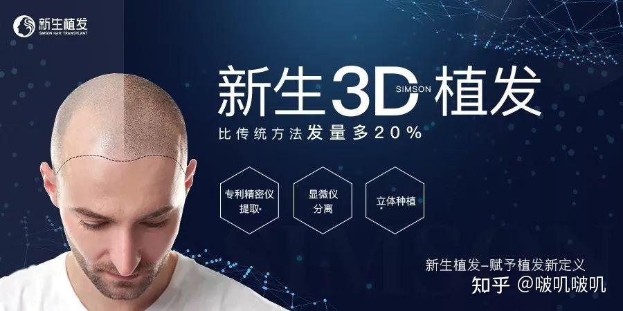 植发台湾专利(国外植发哪里好)