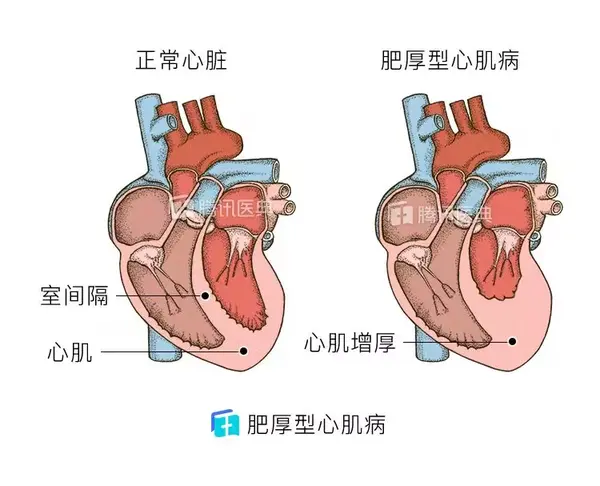 心脏骤停后的黄金4分钟 知乎