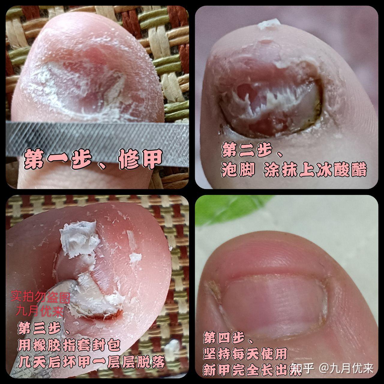 冬枣优质生产新技术问答_试管婴儿真实经验分享_优质问答真实经验分享