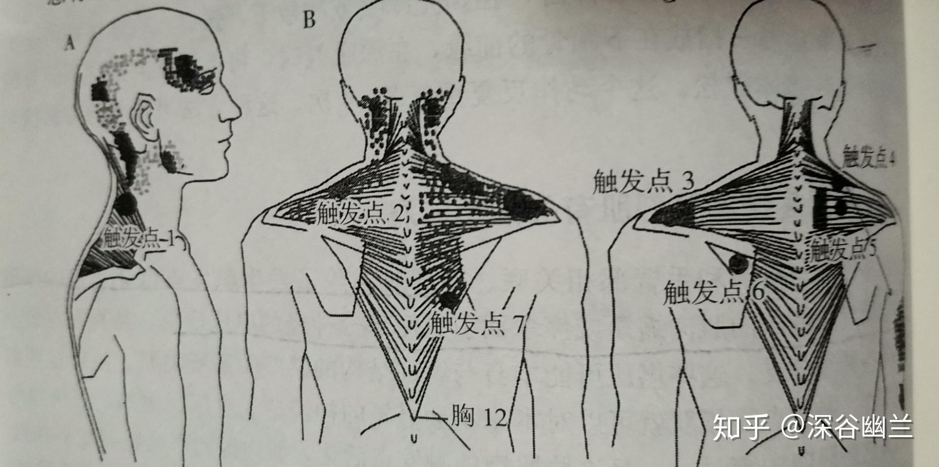 圆肩,耸肩,肩不受压是何因