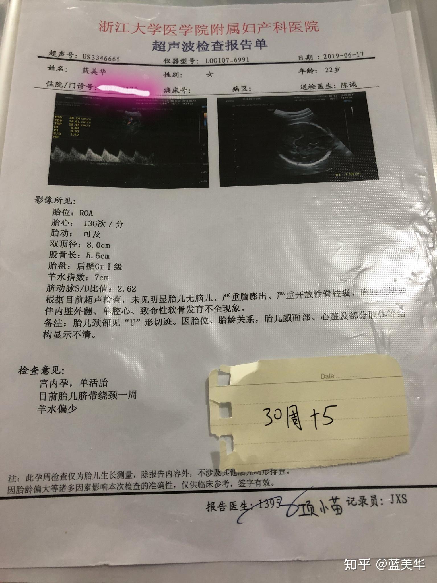怀孕后没有孕吐宝宝发育良好四维时大概会偏小一周的样子但是羊水