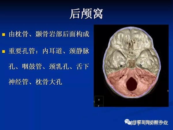 实用、详细的颅底各孔道影像解剖! - 知乎