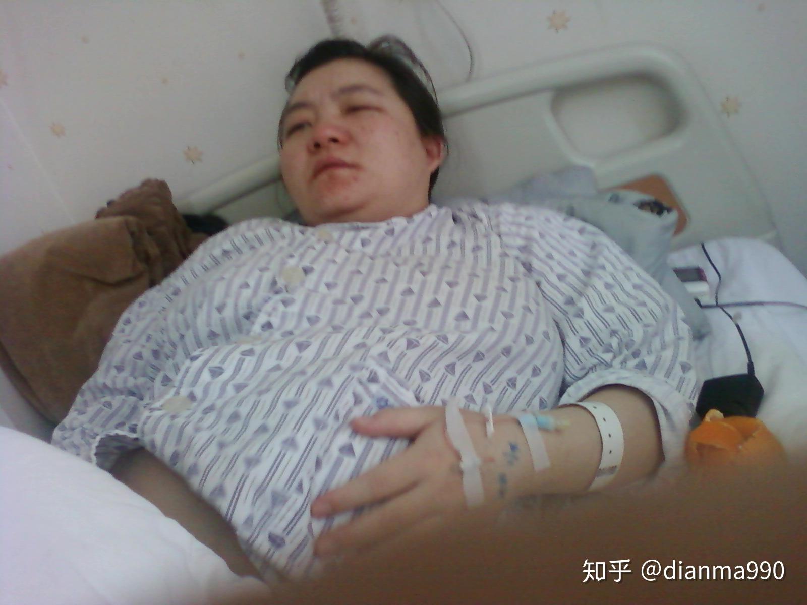 什么原因会引起尿蛋白3+ v2-3eb28f10621460b23b4a310b8038a569_r.jpg