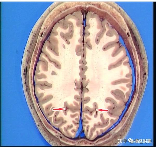最佳推荐 | 高清详细的神经系统解剖学(全) - 知乎