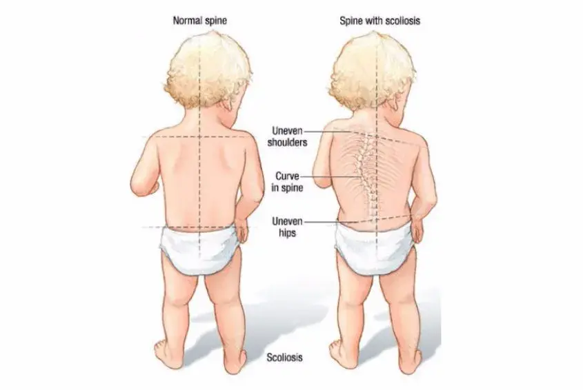 抱着宝宝睡太久会造成宝宝脊椎弯曲真正该注意脊椎的是