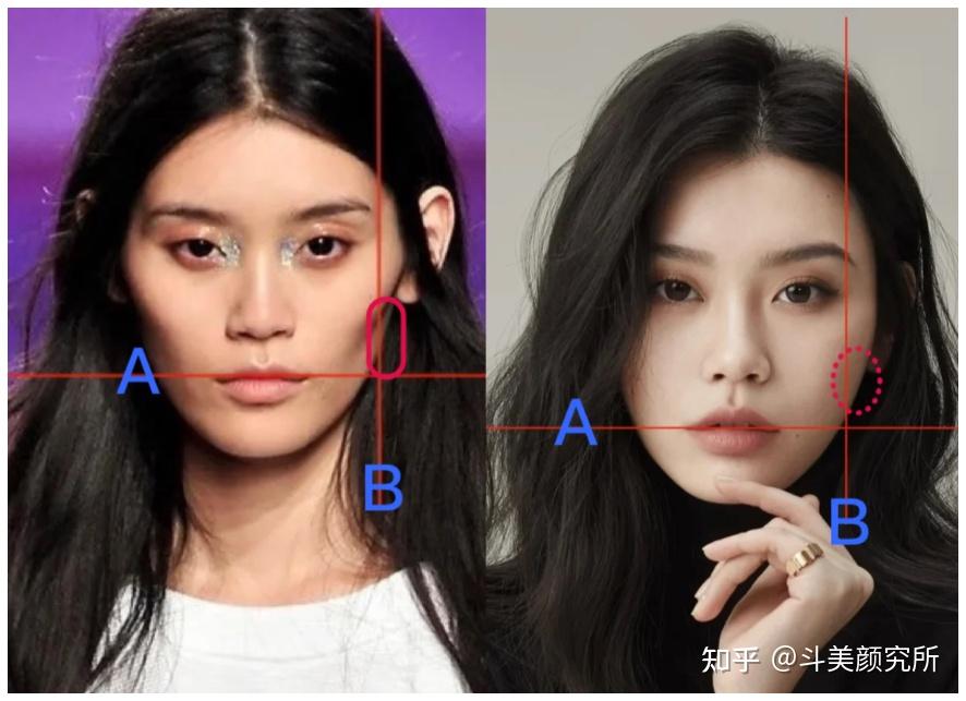 面颊凹陷的原因是什么?如何才能有效改善