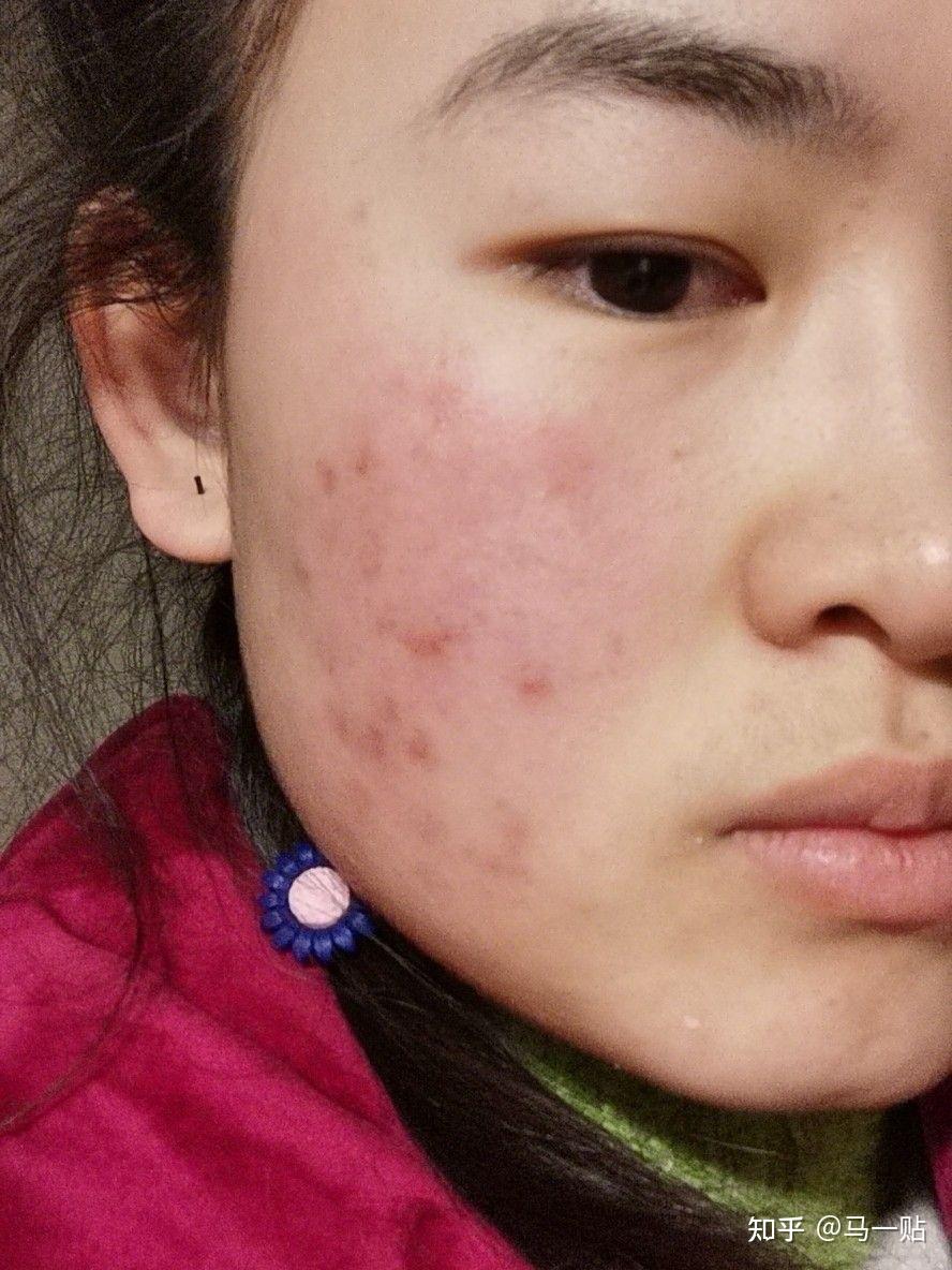 年轻人养肤"上瘾":养肤类化妆品受追捧,年复购率达18%! - 知乎