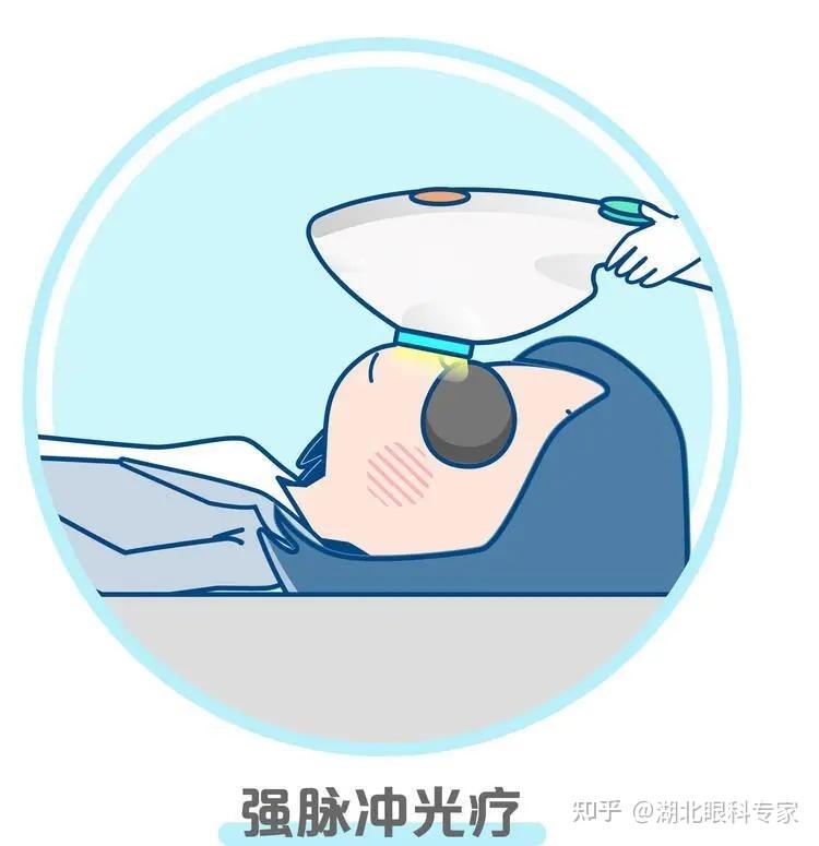 强脉冲光是如何改善干眼的? - 知乎