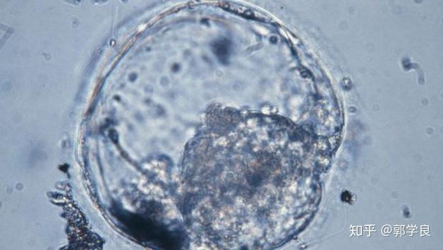 胚胎三整倍体的原因是什么,中美试管婴儿技术对比