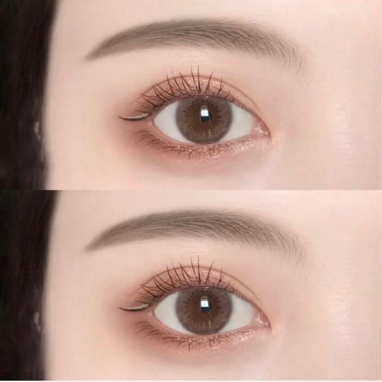 全网挑选双眼皮医生最佳攻略教你判断自己适合什么款式的双眼皮从此