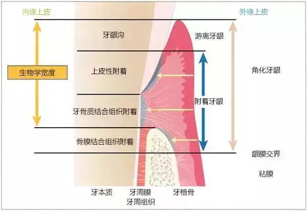 牙周刮治与牙周组织健康比较有口腔保健意识的人