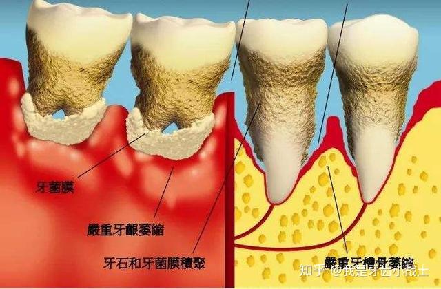 牙痛是什麼情況看完就別問了