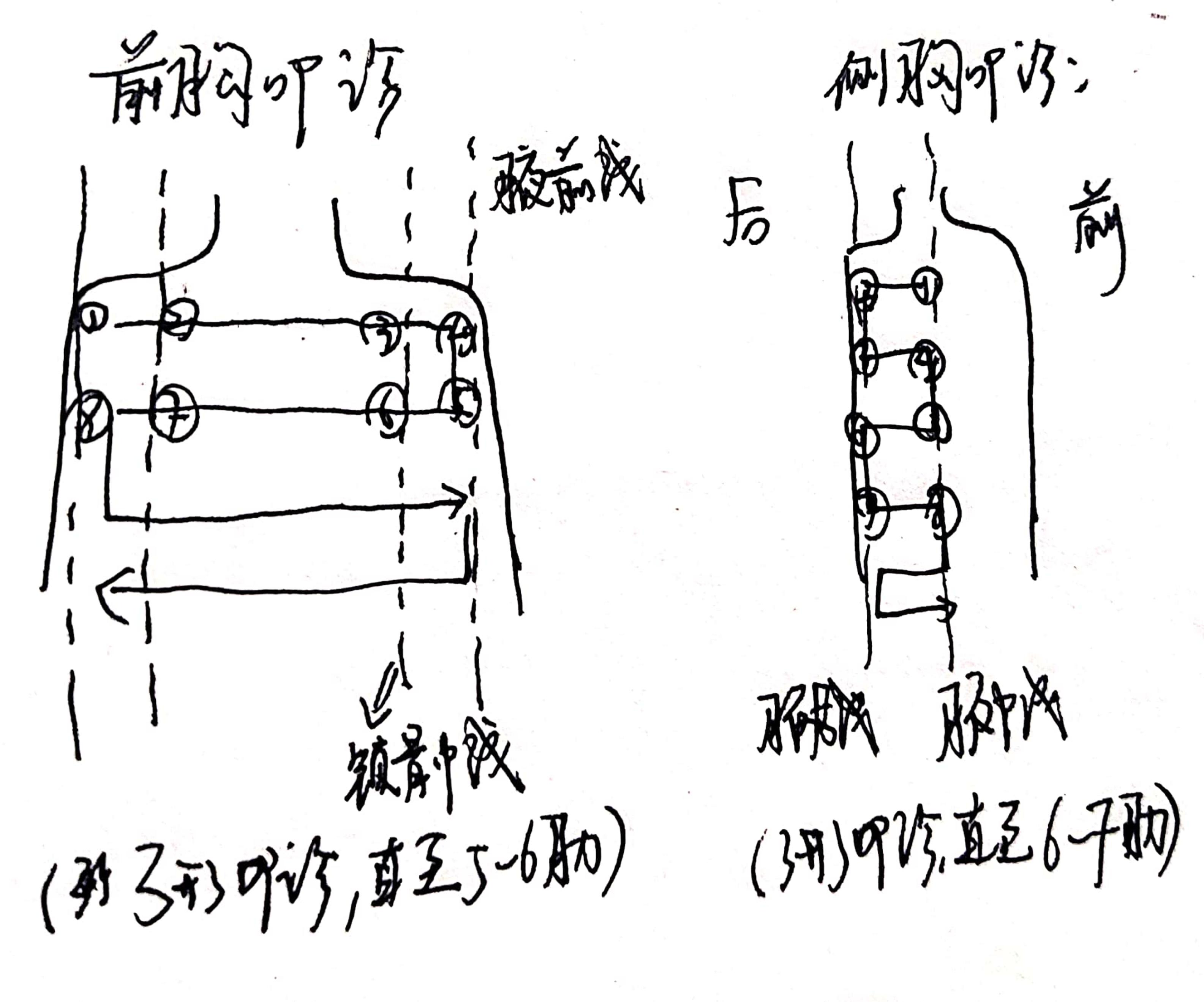 3,叩诊后胸的时候:较为复杂→患者的体位是向前环抱,双手交叉抱住肘部
