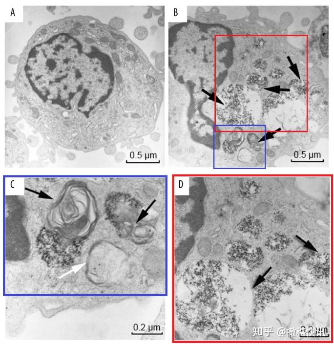 figure3是电子显微镜检测肝细胞自噬实验结果,与中南大学湘雅医院的