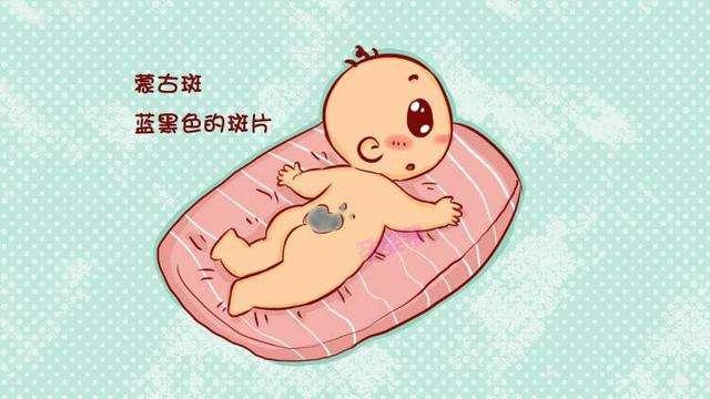 宝宝蒙古斑能自行消退吗 知乎 宝宝蒙古斑能自行消退吗 知乎