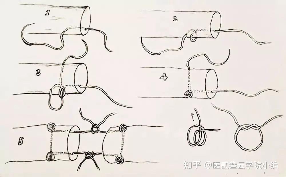 汤氏肌腱缝合法图片