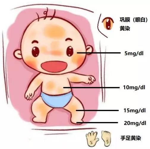 宝宝有黄疸，为什么不能抱去晒太阳？ - 知乎