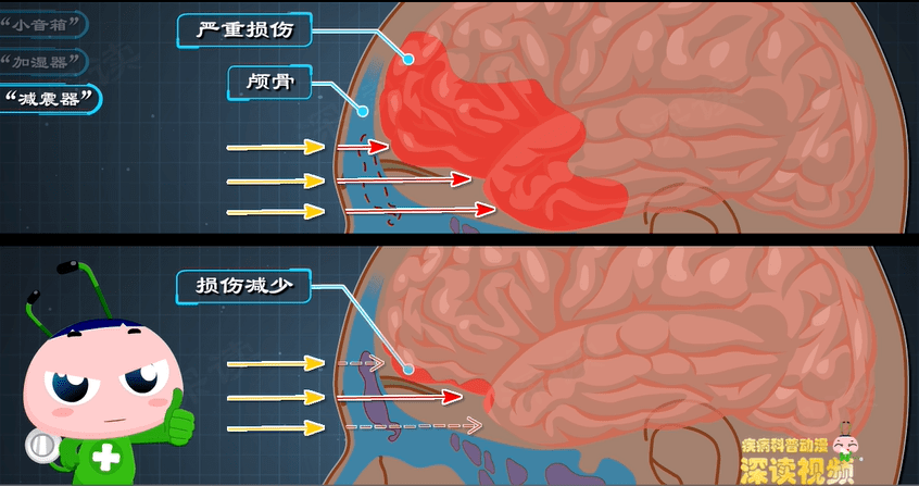鼻涕不止?反复头痛?鼻窦炎是咋回事?鼻窦炎发病机制动漫版 - 知乎