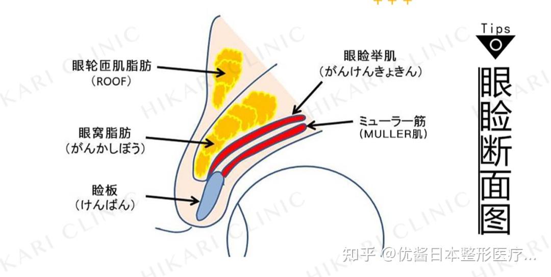 我們先來從眼瞼的結構分析,從表面到內部層次,上眼瞼分別由皮膚,肌肉