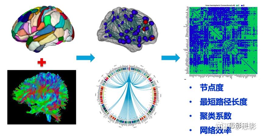思影科技弥散加权成像dwidmri数据处理