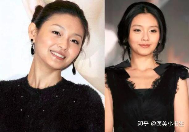 娱乐圈为毛都是冻龄女神?女星30岁,40岁跟20岁没什么差别