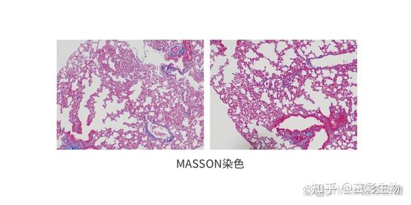 Zcibio Masson染色 一个看组织纤维化的染色实验 知乎